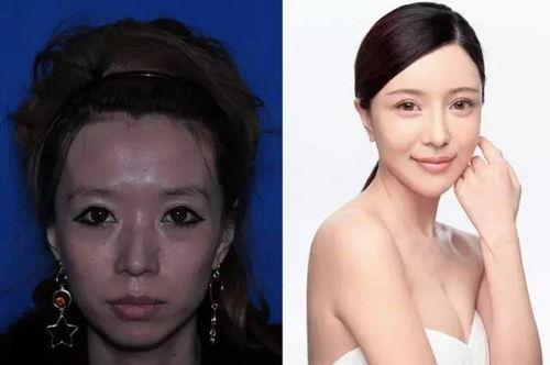 网红 大金 整容前照片,整容前后对比，惊人变化引热议