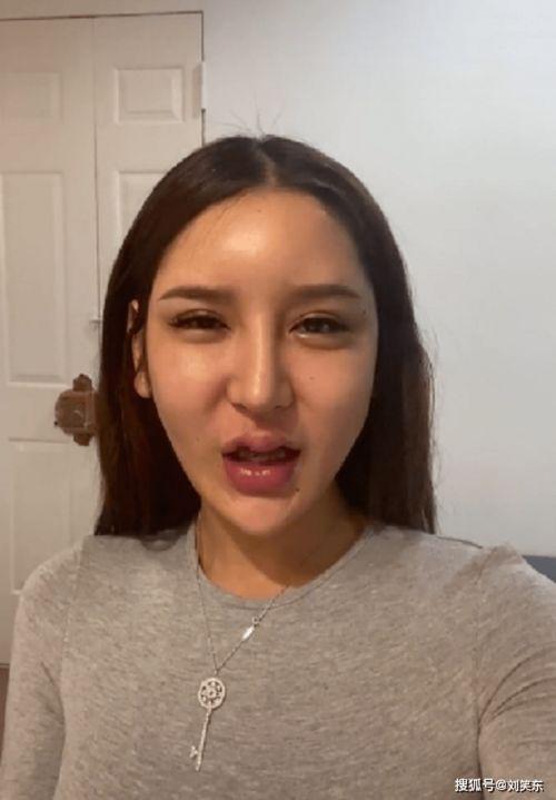 整容失败网红,美丽背后的代价与反思